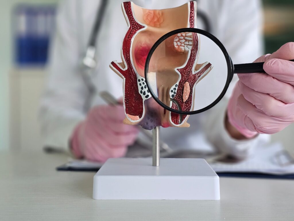 doctor examining scale model of colon